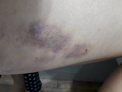 Щоб збільшити малюнок, клацніть по ньому
Назва:  24.jpg
Переглядів: 232
Розмір:  49,1 КБ
ID:	2099