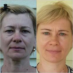 Щоб збільшити малюнок, клацніть по ньому
Назва:  6d8e8481.jpg
Переглядів: 218
Розмір:  338,4 КБ
ID:	5073