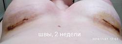 Щоб збільшити малюнок, клацніть по ньому
Назва:  7c721a0c.jpg
Переглядів: 120
Розмір:  29,4 КБ
ID:	9375
