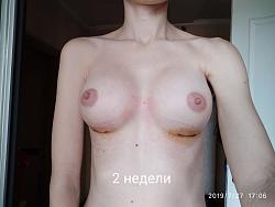 Щоб збільшити малюнок, клацніть по ньому
Назва:  977f5c1d.jpg
Переглядів: 176
Розмір:  54,2 КБ
ID:	9378